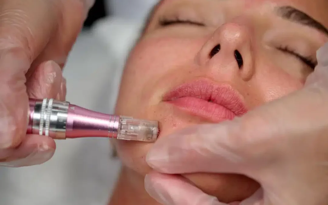 EXOSOME THERAPY IS THE NEXT BIG THING IN AESTHETIC MEDICINE—HERE’S HOW IT WORKS